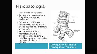 Farmacia Fisiopatología Asma [upl. by Nsaj]