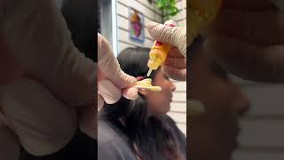 How to get rid of industrial piercing bumps using Base Laboratories Piercing Bump Treatment Oil [upl. by Pollak]