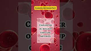 Clogged Arteries Prevent Cholesterol Buildup shorts [upl. by Slyke145]