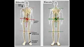 Avaliação Comprimento dos Membros Inferiores DESNÍVEL PÉLVICO Clínica Fisioterapia Dr Robson Sitta [upl. by Annairba]