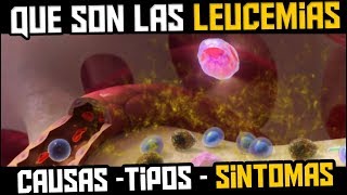 QUE ES LA LEUCEMIA  TIPOS SINTOMAS CAUSAS Y TRATAMIENTO [upl. by Dilly311]