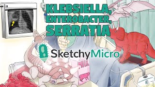 Klebsiella Enterobacter Serratia  SketchyMicro  Sketchy Medical USMLE Step 1 [upl. by Amiel730]