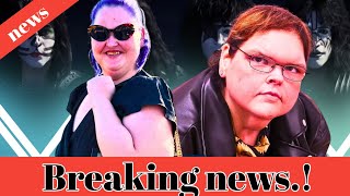 1000Lb Sisters Tammys Skin Removal Surgery Might Ruin Her Personal Brand She Should Think Twice [upl. by Ecitsuj]