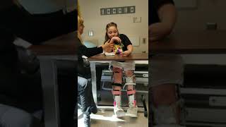 Arthrogryposis Diagnosis and Treatment  Patient Testimonial Aubrey [upl. by Muhcan129]