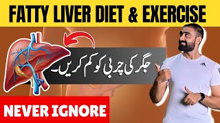 NEVER IGNORE Fatty Liver  Fatty Liver Diet amp Exercise  Bilal Kamoka Fitness [upl. by Mackoff]