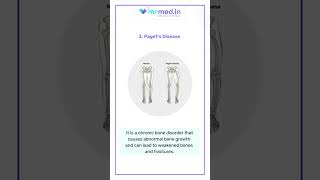 Types Of Bone Conditions In Human I MrMed [upl. by Bobbette603]