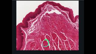 Respiratory System Histology  Vocal Folds [upl. by Saxen]