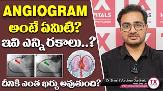 Angiogram అంటే  What is Angiogram  Angiogram Cost in Hyderabad  Dr Sasi Vardhan  TX Hospitals [upl. by Solis]