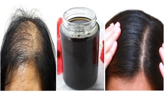 How To Use Kalonji Hair Oil to Cure Baldness Hair Loss  Get Thick Hair Long Hair  Priya Malik [upl. by Wertz593]