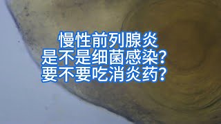 慢性前列腺炎是不是细菌感染要不要吃消炎药？ [upl. by Pinkham]