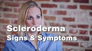 Signs and Symptoms of Scleroderma  Johns Hopkins [upl. by Aettam]