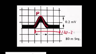 CURSO DE ELECTROCARDIOGRAFIA 14  UN CICLO CARDÍACO EXPRESADO EN TÉRMINOS ELÉCTRICOS NOMENCLATURA [upl. by Nilo288]