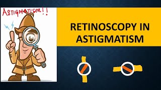 RETINOSCOPY in ASTIGMATISM  Break intensity  brightness and skew  Straddling [upl. by Aseeram899]