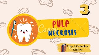 What is Pulp Necrosis amp How Genes Play A Role In It [upl. by Davon351]