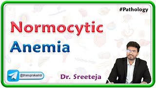 5 Normocytic Anemia  USMLE Step Pathology [upl. by Arahd358]