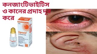 সিপ্রোসিন ড্রপের কাজ কি।Ciprocin eye drop। [upl. by Inamik536]