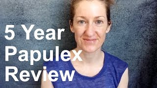 Papulex Review  Update 2018 Edition [upl. by Eelrebma982]