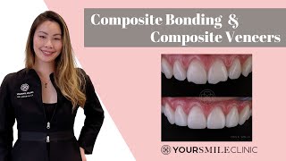 What is Composite Bonding and Composite Veneers What you need to know before you have treatment [upl. by Dranyer652]