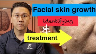 Growths on YOUR Face  Identifying and Treatment Part 12 [upl. by Nysa]