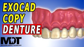 Copy Denture with Exocad  Tutorial To Copy Any Denture [upl. by Maccarone]