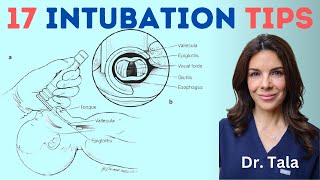 16 tricks for a successful NEONATAL endotracheal intubation [upl. by Zubkoff]