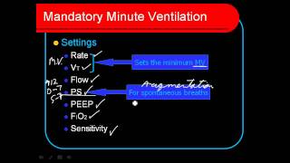 Mandatory Minute Ventilation MMV [upl. by Ahtan]