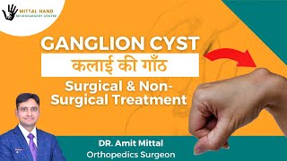 कलाईकीसिस्ट Wrist Ganglion Cyst Hindi Ganglion Cyst Surgical and non Surgical Treatments [upl. by Clynes684]