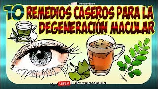 Degeneracion Macular  10 Remedios Caseros para la Degeneracion Macular🧐🤓 [upl. by Aiyekal]