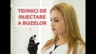 Tehnici de injectare a buzelor cu acid hialuronic [upl. by Yate]