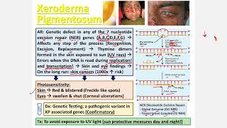 Xeroderma Pigmentosa CBL [upl. by Bolten]