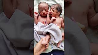 Adorable Twin Newborn Babies Vs Cutest Single Newborn Baby [upl. by Redleh]