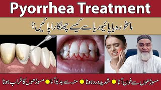 Pyorrhea Treatment In UrduHindi Maskhora Ka Ilaj Danto Ki Dard Ka Ilaj  AlRazaqi Health Recover [upl. by Anasor]