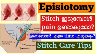 Episiotomy Malayalam│How to take care of Stitches After Normal Delivery│When to consult a Doctor [upl. by Lello]