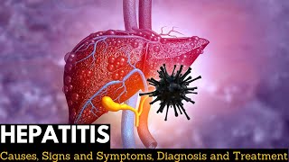 Hepatitis Causes Signs and Symptoms Diagnosis and Treatment [upl. by Acinoed]