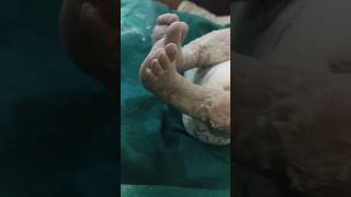 Baby just delivery baby viralvideo shorts [upl. by Prunella]