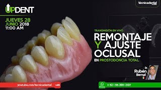 Remontaje y ajuste oclusal en prostodoncia total [upl. by Colley]