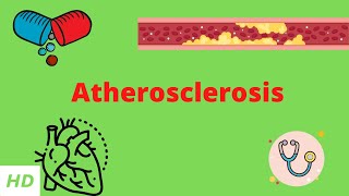 Atherosclerosis Causes Signs and Symptoms Diagnosis and Treatment [upl. by Ecela]