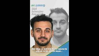 hairtransplant SAÇ EKİMİ  ÖNCESİSONRASI  HAIR TRANSPLANT  BEFOREAFTER [upl. by Adnaw]