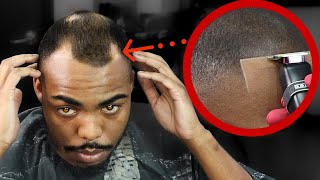 FIXING MY CLIENTS BALD SPOTS😳 HIGH BALD FADE FADED BEARD HAIRCUT TUTORIAL [upl. by Gris913]