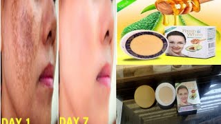 fresh amp white beauty cream result use price side effects Hindi review [upl. by Anivlem]