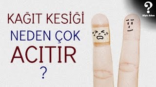 Kağıt Kesiği Neden Çok Acıtır [upl. by Rehpotirhc435]