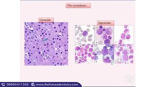 Odontogenic cysts and Histology of radicular cyst  NEET MDS  Oral pathology [upl. by Farly]