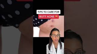 How To Get Rid of Butt Acne According to a Dermatologist shorts [upl. by Lord]