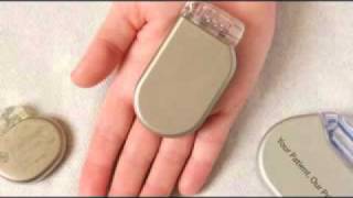 How pacemakers and implantable defibrillators are implanted and used [upl. by Annodas]