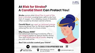 Reduce Stroke Risk with Carotid Stenting [upl. by Jehu767]