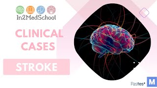 Stroke Clinical Case [upl. by Aissac]