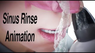 Sinus Rinse Animation [upl. by Nevear649]