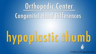 hypoplastic thumb  congenital hand differences  Boston Childrens Hospital [upl. by Lacey134]