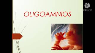 Polihidramnios y Oligoamnios [upl. by Hgeilyak624]