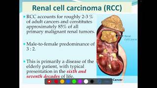 Renal cell carcinoma  RCC  Aetiology  Histopathology  spread [upl. by Alameda]